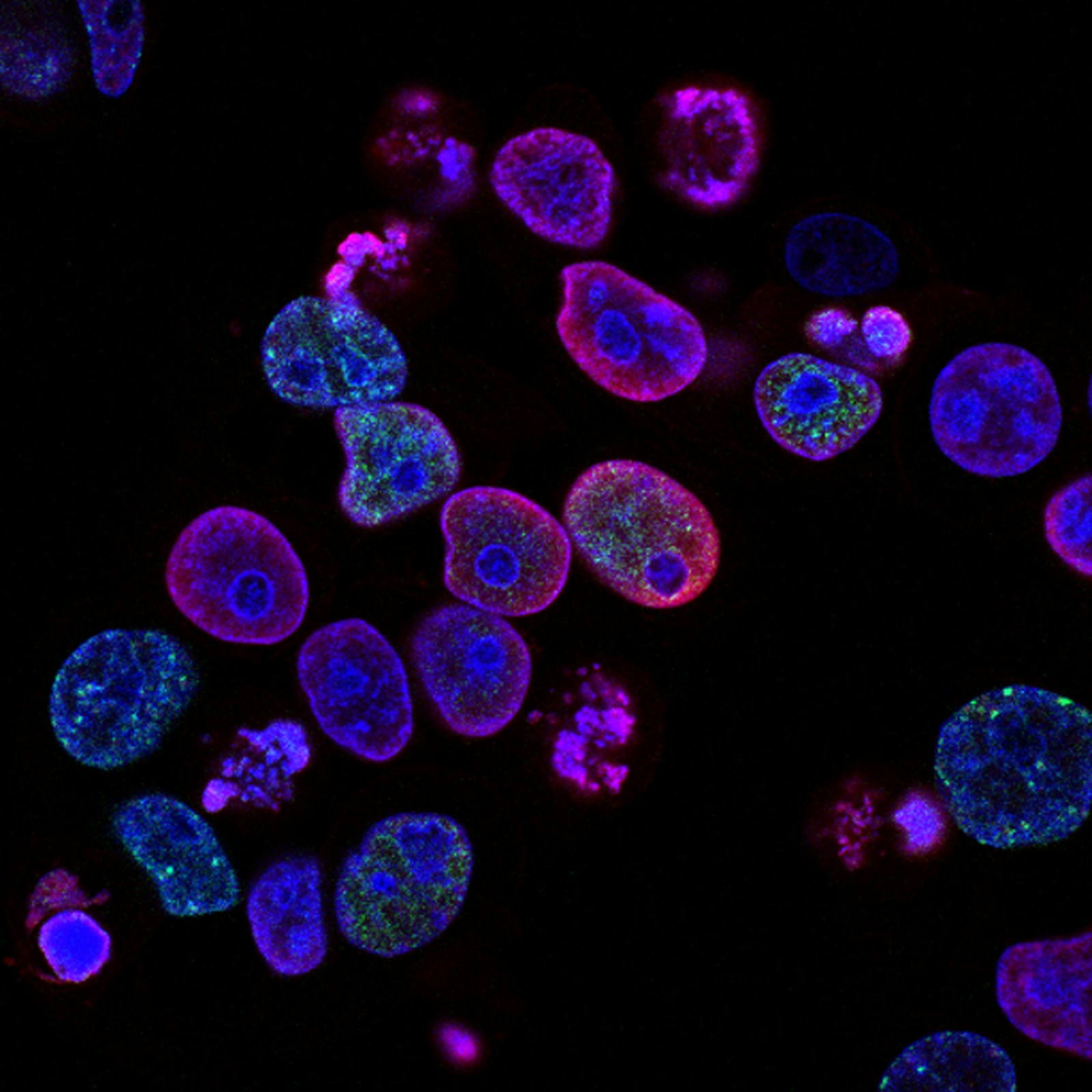 Fluorescent microscopy image of cells used as a visual symbol of medical research